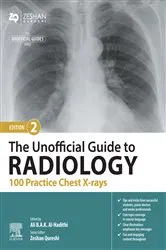 Book cover of The Unofficial Guide to Radiology: 100 Practice Chest X-rays - E-Book (2nd ed.) by Al-Hadithi MB BChir, MA(Cantab), MRCP(UK), AFHEA, PGCert (Med Ed), Ali B.A.K.