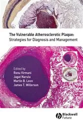 Book cover of The Vulnerable Atherosclerotic Plaque by Renu Virmani