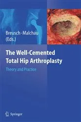 Book cover of The Well-Cemented Total Hip Arthroplasty by Steffen Breusch