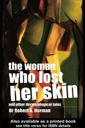 Book cover of The Woman Who Lost Her Skin by Rob Norman