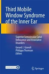 Book cover of Third Mobile Window Syndrome of the Inner Ear by Gerard J. Gianoli