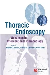 Book cover of Thoracic Endoscopy by Michael J. Simoff