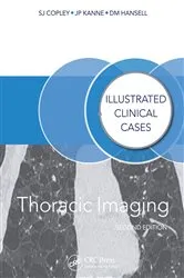 Book cover of Thoracic Imaging (2nd ed.) by Sue Copley