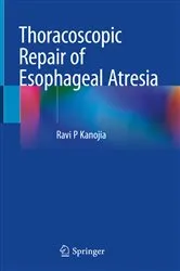 Book cover of Thoracoscopic Repair of Esophageal Atresia by Ravi P Kanojia