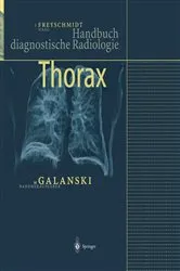 Book cover of Thorax by Jürgen Freyschmidt