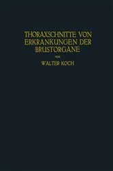 Book cover of Thoraxschnitte von Erkrankungen der Brustorgane by Walter Koch
