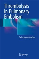 Book cover of Thrombolysis in Pulmonary Embolism by Carlos Jerjes-Sánchez