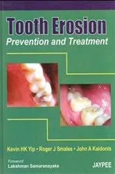 Book cover of Tooth Erosion (Prevention & Treatment) by Kevin H.K. Yip
