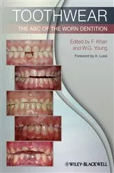 Book cover of Toothwear by Farid Khan