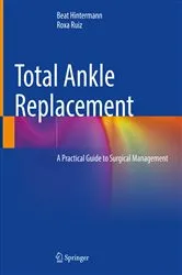 Book cover of Total Ankle Replacement by Beat Hintermann