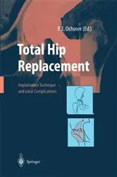 Book cover of Total Hip Replacement by P.E. Ochsner
