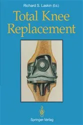 Book cover of Total Knee Replacement by Barry C. Kleeman