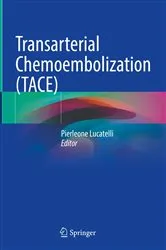 Book cover of Transarterial Chemoembolization (TACE) by Pierleone Lucatelli