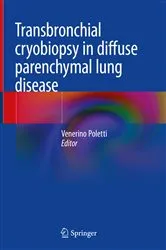 Book cover of Transbronchial cryobiopsy in diffuse parenchymal lung disease by Venerino Poletti