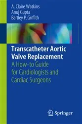 Book cover of Transcatheter Aortic Valve Replacement by A. Claire Watkins