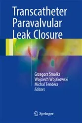 Book cover of Transcatheter Paravalvular Leak Closure by Grzegorz Smolka