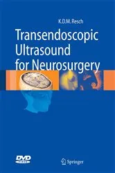 Book cover of Transendoscopic Ultrasound for Neurosurgery by Klaus Dieter Maria Resch