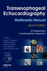 Book cover of Transesophageal Echocardiography Multimedia Manual (2nd ed.) by Unknown