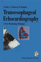 Book cover of Transesophageal Echocardiography by Unknown