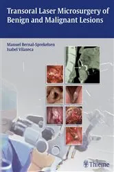 Book cover of Transoral Laser Microsurgery of Benign and Malignant Lesions by Manuel Bernal-Sprekelsen