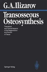 Book cover of Transosseous Osteosynthesis by Gavriil A. Ilizarov