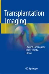 Book cover of Transplantation Imaging by Ghaneh Fananapazir