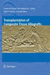 Book cover of Transplantation of Composite Tissue Allografts by Chad R. Gordon