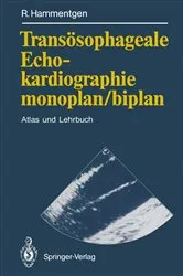 Book cover of TransÃ¶sophageale Echokardiographie monoplan/biplan by Ralf Hammentgen