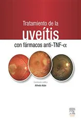 Book cover of Tratamiento de la uveítis con fármacos anti-TNF-alfa by Alfredo Adán Civera