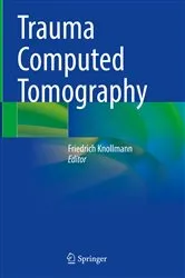 Book cover of Trauma Computed Tomography by Friedrich Knollmann