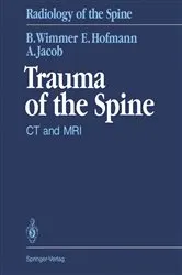 Book cover of Trauma of the Spine by Berthold Wimmer