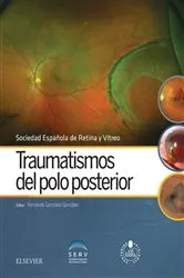 Book cover of Traumatismos del polo posterior by Fernando González González