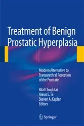 Book cover of Treatment of Benign Prostatic Hyperplasia: Modern Alternative to Transurethral Resection of the Prostate by Bilal Chughtai