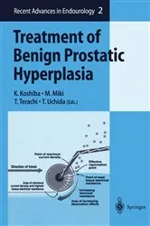 Book cover of Treatment of Benign Prostatic Hyperplasia by K. Koshiba