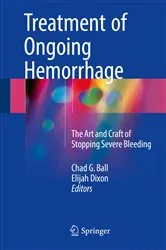 Book cover of Treatment of Ongoing Hemorrhage by Chad G. Ball