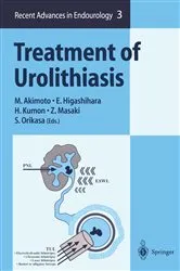 Book cover of Treatment of Urolithiasis by M. Akimoto
