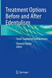 Book cover of Treatment Options Before and After Edentulism by Yasemin Özkan