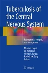 Book cover of Tuberculosis of the Central Nervous System by Mehmet Turgut