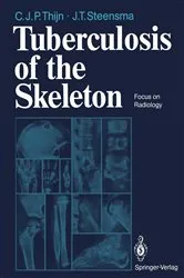 Book cover of Tuberculosis of the Skeleton by Cornelis J.P. Thijn