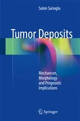Book cover of Tumor Deposits by Sulen Sarioglu