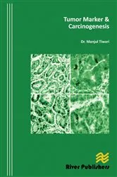 Book cover of Tumor Marker and Carcinogenesis by Manjul Tiwari