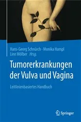 Book cover of Tumorerkrankungen der Vulva und Vagina by Hans-Georg Schnürch