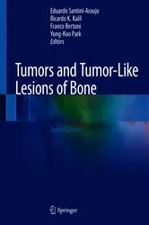 Book cover of Tumors and Tumor-Like Lesions of Bone (2nd ed.) by Eduardo Santini-Araujo
