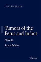 Book cover of Tumors of the Fetus and Infant (2nd ed.) by Hart Isaacs