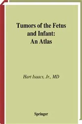 Book cover of Tumors of the Fetus and Infant by Hart Jr. Isaacs