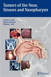 Book cover of Tumors of the Nose, Sinuses and Nasopharynx by Valerie J. Lund