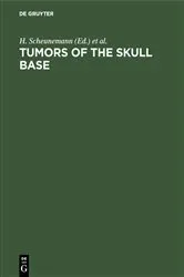 Book cover of Tumors of the skull base by H. Scheunemann