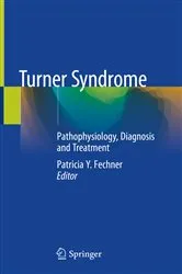Book cover of Turner Syndrome by Mary Golanna