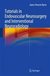 Book cover of Tutorials in Endovascular Neurosurgery and Interventional Neuroradiology by Unknown