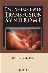 Book cover of Twin-to-Twin Transfusion Syndrome by Daniel W. Skupski
